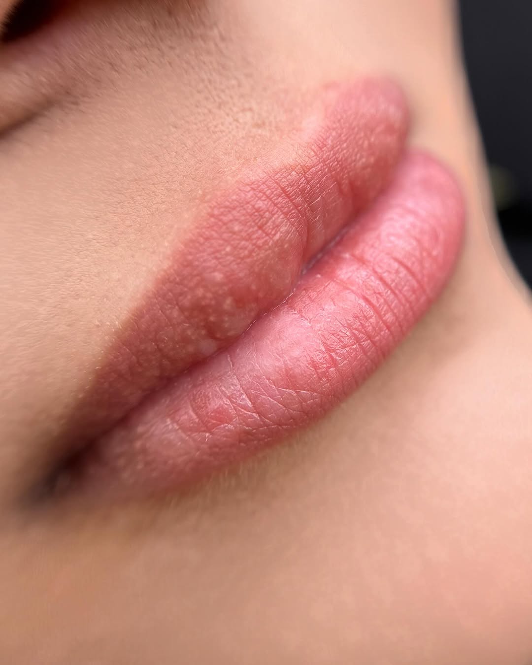 post